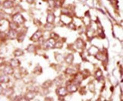 BUBR1 Antibody in Immunohistochemistry (IHC)