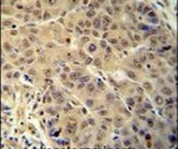 BUD13 Antibody in Immunohistochemistry (IHC)