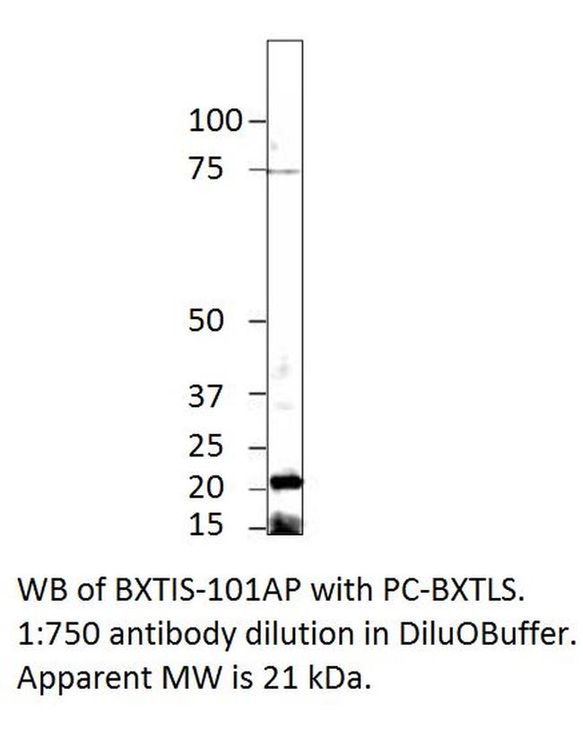 Beta crystallin S Antibody in Western Blot (WB)