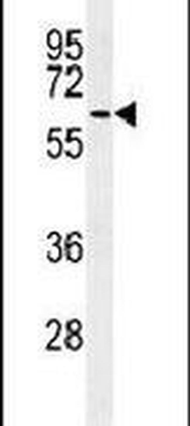 ATG14 Antibody in Western Blot (WB)