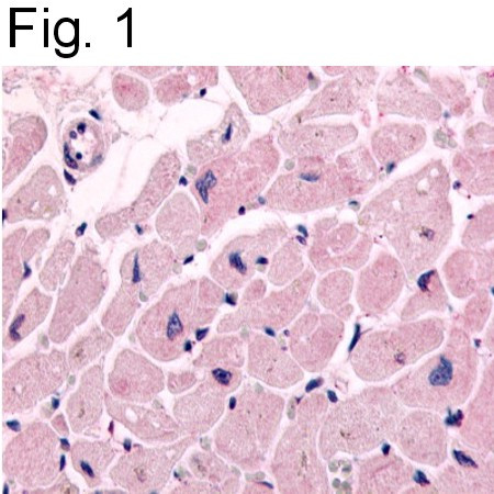 beta-2 Adrenergic Receptor Antibody in Immunohistochemistry (IHC)