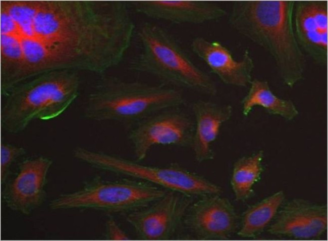beta Tubulin Loading Control Antibody in Immunocytochemistry (ICC/IF)