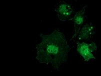 Beta-catenin Antibody in Immunocytochemistry (ICC/IF)