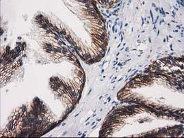 Beta-catenin Antibody in Immunohistochemistry (Paraffin) (IHC (P))