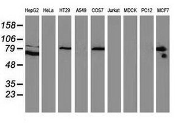 Beta-catenin Antibody in Western Blot (WB)