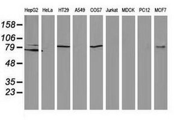 Beta-catenin Antibody in Western Blot (WB)