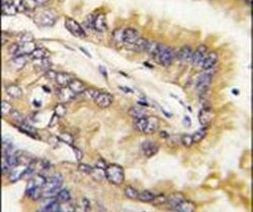 BID Antibody in Immunohistochemistry (IHC)