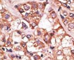 BIK Antibody in Immunohistochemistry (IHC)