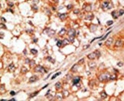 Bim Antibody in Immunohistochemistry (IHC)