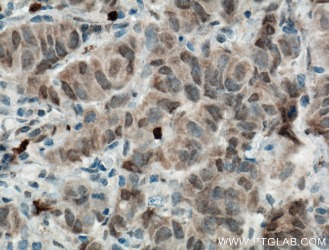 DNAJB9 Antibody in Immunohistochemistry (Paraffin) (IHC (P))