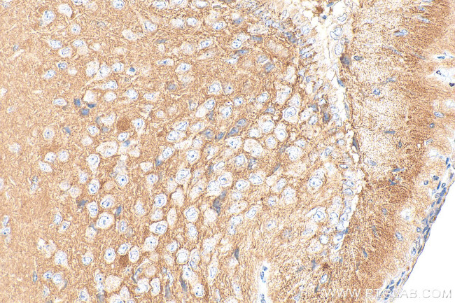 GPM6A Antibody in Immunohistochemistry (Paraffin) (IHC (P))