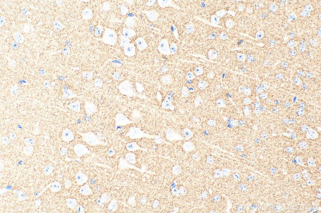 STXBP1 Antibody in Immunohistochemistry (Paraffin) (IHC (P))