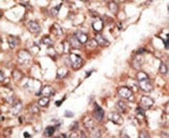 BMP-3 Antibody in Immunohistochemistry (IHC)