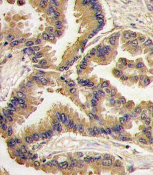 BMP-6 Antibody in Immunohistochemistry (IHC)