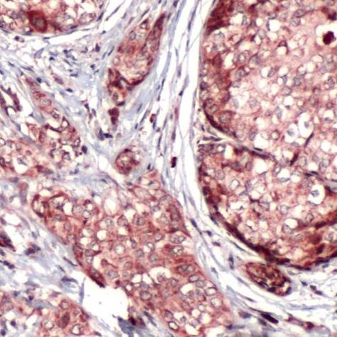 BNIP3L Antibody in Immunohistochemistry (IHC)
