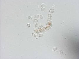 BrdU Antibody in Immunocytochemistry (ICC/IF)