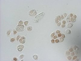 BrdU Antibody in Immunocytochemistry (ICC/IF)