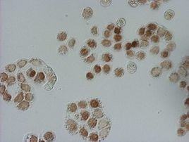 BrdU Antibody in Immunocytochemistry (ICC/IF)