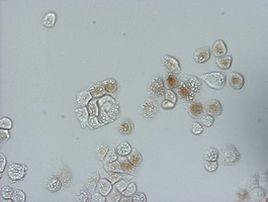 BrdU Antibody in Immunocytochemistry (ICC/IF)