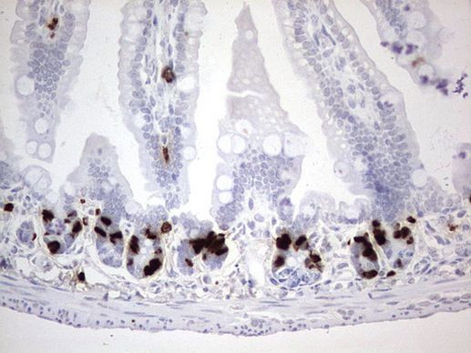 BrdU Antibody in Immunohistochemistry (Paraffin) (IHC (P))