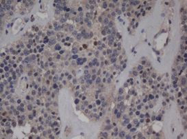 C-Jun Antibody in Immunohistochemistry (Paraffin) (IHC (P))