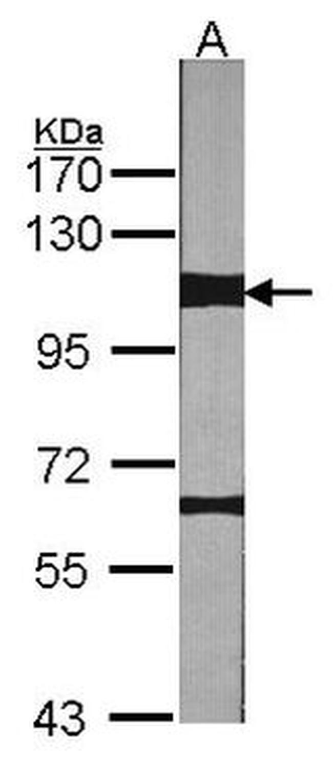 MERTK Antibody in Western Blot (WB)