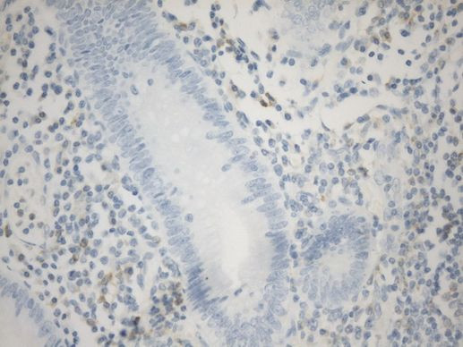 C10orf54 Antibody in Immunohistochemistry (Paraffin) (IHC (P))