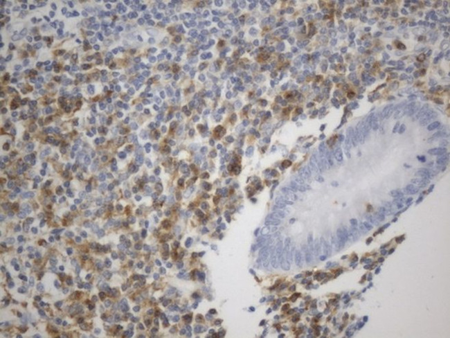 C10orf54 Antibody in Immunohistochemistry (Paraffin) (IHC (P))