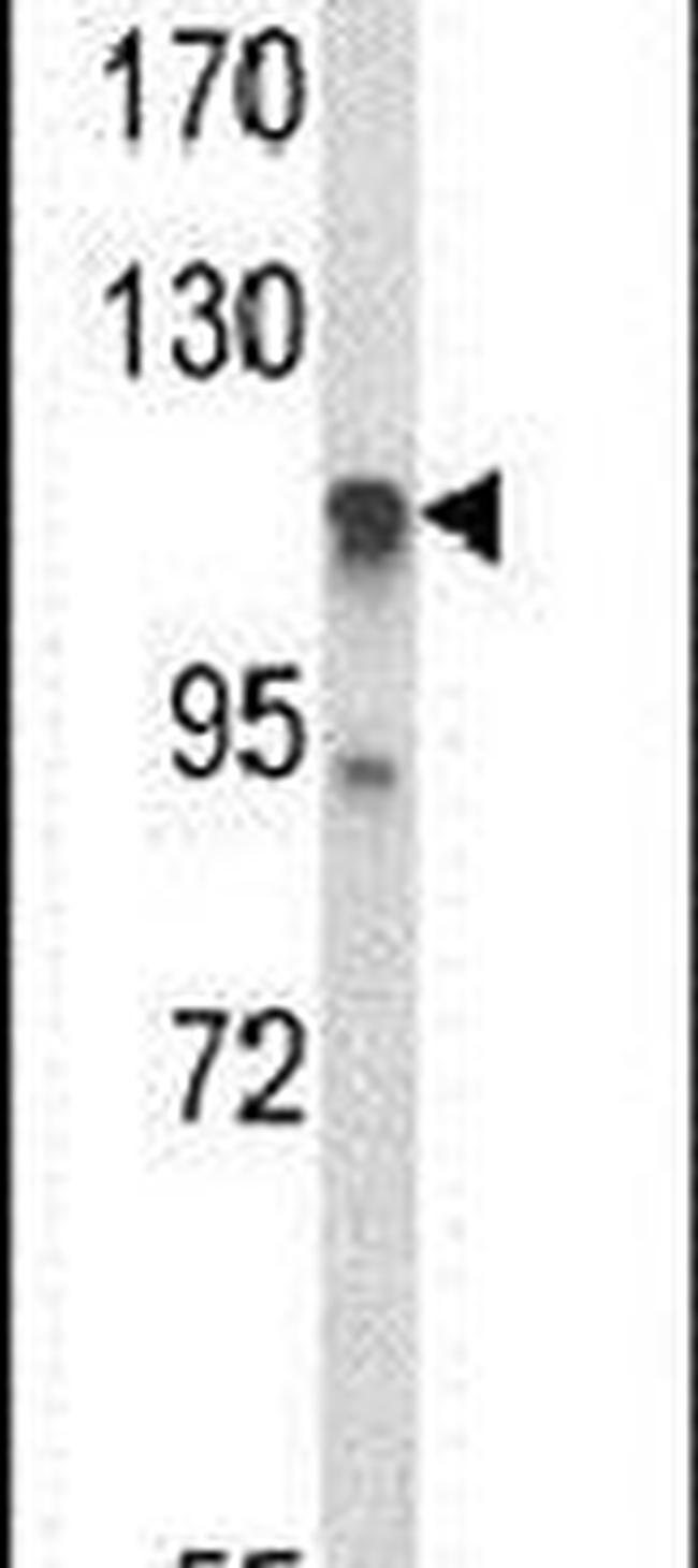 C11orf30 Antibody in Western Blot (WB)