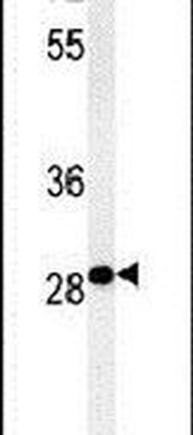 C11orf46 Antibody in Western Blot (WB)