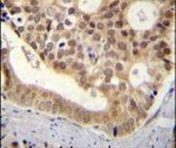 C11orf53 Antibody in Immunohistochemistry (IHC)