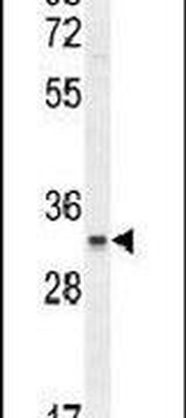 C11orf74 Antibody in Western Blot (WB)