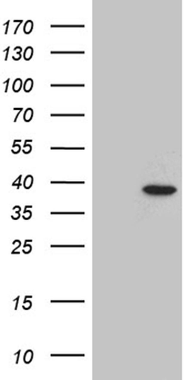 C12orf32 Antibody in Western Blot (WB)