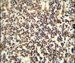 PARPBP Antibody in Immunohistochemistry (IHC)