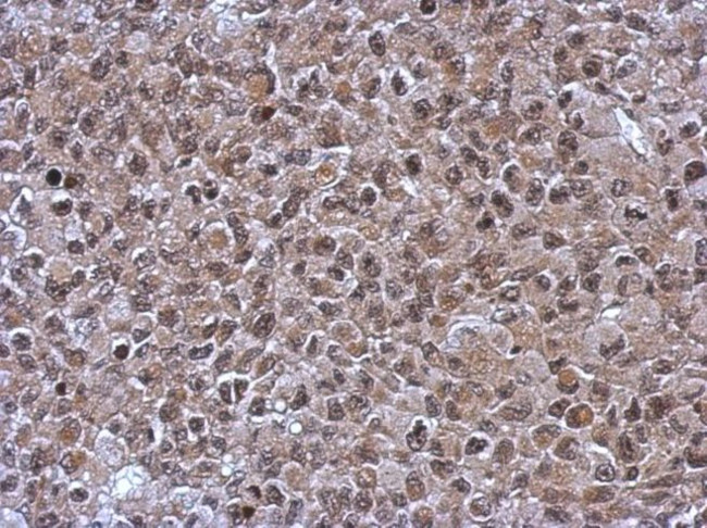 C14orf140 Antibody in Immunohistochemistry (IHC)