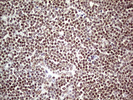RTRAF Antibody in Immunohistochemistry (Paraffin) (IHC (P))