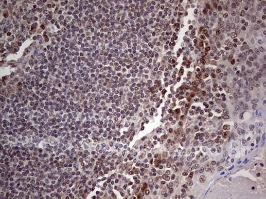 RTRAF Antibody in Immunohistochemistry (Paraffin) (IHC (P))