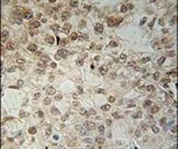 C14orf179 Antibody in Immunohistochemistry (IHC)