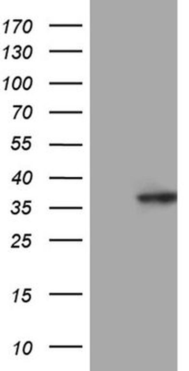 C14orf80 Antibody in Western Blot (WB)