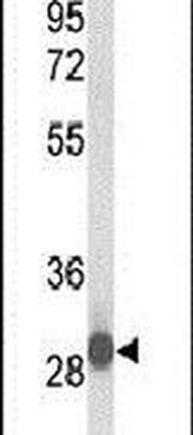 C15orf29 Antibody in Western Blot (WB)