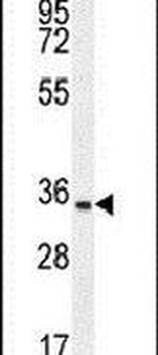 C15orf41 Antibody in Western Blot (WB)