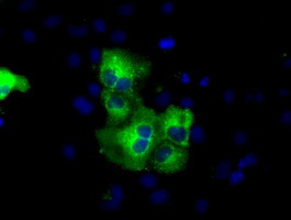 C17orf28 Antibody in Immunocytochemistry (ICC/IF)