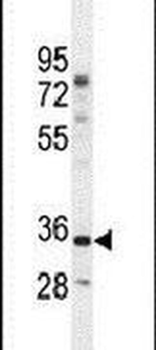 C17orf59 Antibody in Western Blot (WB)