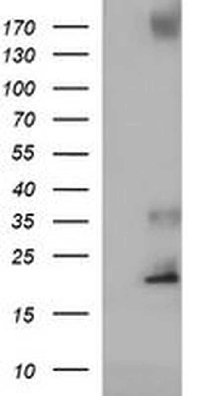C17orf62 Antibody in Western Blot (WB)