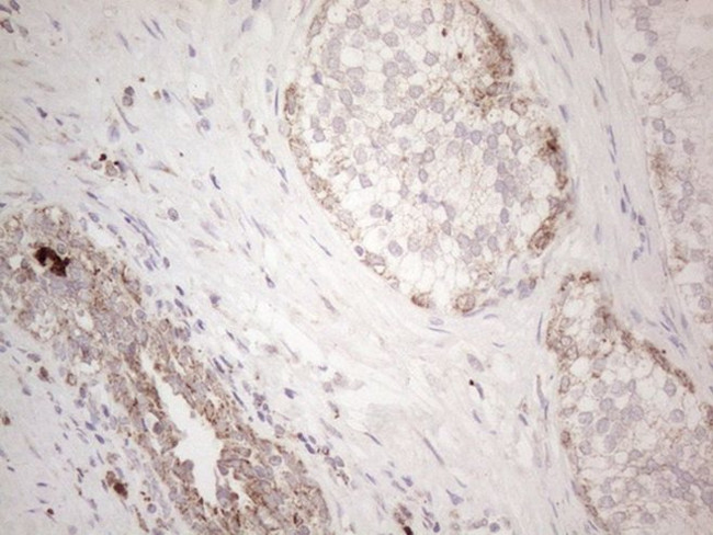 C19ORF80 Antibody in Immunohistochemistry (Paraffin) (IHC (P))