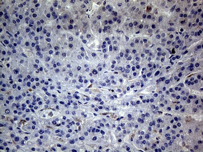 C19ORF80 Antibody in Immunohistochemistry (Paraffin) (IHC (P))
