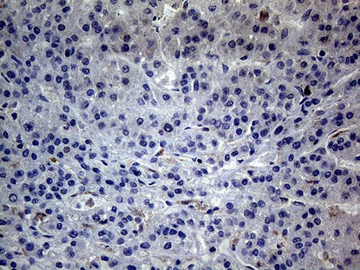 C19ORF80 Antibody in Immunohistochemistry (Paraffin) (IHC (P))