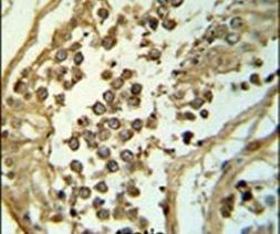 C19orf18 Antibody in Immunohistochemistry (IHC)
