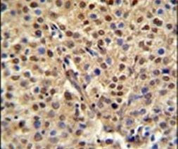 C19orf21 Antibody in Immunohistochemistry (IHC)