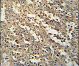 C19orf39 Antibody in Immunohistochemistry (IHC)